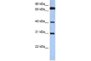 DHRSX antibody used at 0. (DHRSX 抗体  (C-Term))
