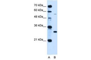 Image no. 2 for anti-Hemochromatosis (HFE) (AA 149-198) antibody (ABIN6736669) (HFE 抗体  (AA 149-198))
