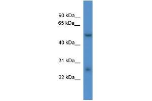 Rat Liver; WB Suggested Anti-Pigw Antibody Titration: 0. (PIGW 抗体  (Middle Region))