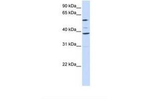 Image no. 1 for anti-Solute Carrier Family 25 (Mitochondrial Carrier, Graves Disease Autoantigen), Member 16 (SLC25A16) (AA 218-267) antibody (ABIN6738110) (SLC25A16 抗体  (AA 218-267))