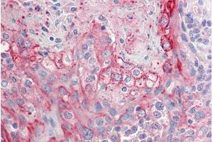 ABIN571241 (5µg/ml) staining of paraffin embedded Human Tonsil. (RHCG 抗体  (Internal Region))