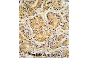 Immunohistochemistry (Paraffin-embedded Sections) (IHC (p)) image for anti-MOB1, Mps One Binder Kinase Activator-Like 1B (MOBKL1B) (AA 188-216), (C-Term) antibody (ABIN391568)