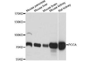 Western blot analysis of extracts of various cell lines, using PCCA antibody. (PCCA 抗体  (AA 449-728))