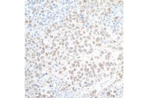 Immunohistochemistry (IHC) image for anti-PHD Finger Protein 8 (PHF8) (AA 650-700) antibody (ABIN7454781) (PHF8 抗体  (AA 650-700))