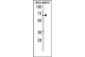 Western blot analysis of RXRB Antibody (Center) Cat. (Retinoid X Receptor beta 抗体  (Middle Region))