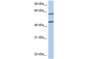 WB Suggested Anti-NTN4 Antibody Titration:  0. (Netrin 4 抗体  (N-Term))