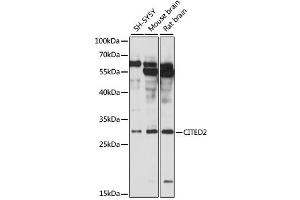 Western blot analysis of extracts of various cell lines, using CITED2 antibody (ABIN6291914) at 1:3000 dilution. (CITED2 抗体)