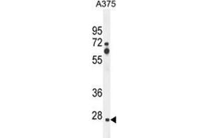 ZCCHC17 Antibody (Center) western blot analysis in A375 cell line lysates (35 µg/lane). (ZCCHC17 抗体  (Middle Region))
