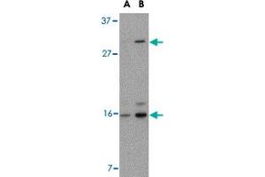 Western blot analysis of DRAM in 293 cell lysate with DRAM polyclonal antibody  at (A) 0. (DRAM 抗体  (C-Term))
