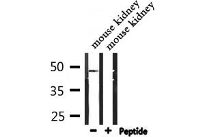Western blot analysis of extracts from mouse kidney, using IP6K2 Antibody. (IP6K2 抗体  (Internal Region))