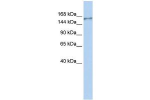 WB Suggested Anti-NBEAL1 Antibody Titration:  0. (NBEAL1 抗体  (N-Term))