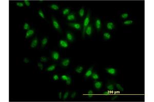 Immunofluorescence of monoclonal antibody to NR0B1 on HeLa cell. (NR0B1 抗体  (AA 361-470))