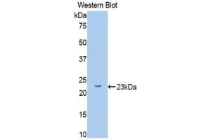 Western blot analysis of the recombinant protein. (GCKR 抗体  (AA 90-286))