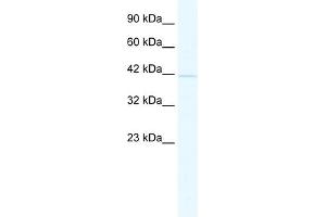 Western Blotting (WB) image for anti-Nucleus Accumbens Associated 1, BEN and BTB (POZ) Domain Containing (NACC1) (Middle Region) antibody (ABIN2775909)
