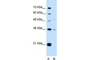 Western Blotting (WB) image for anti-Uronyl-2-Sulfotransferase (UST) antibody (ABIN2462994)