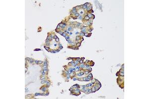 Immunohistochemistry (IHC) image for anti-Dynein, Light Chain, Roadblock Type 1 (DYNLRB1) (AA 1-63) antibody (ABIN7266866)