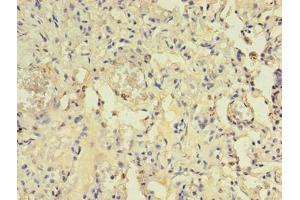 Immunohistochemistry (IHC) image for anti-ArfGAP with Coiled-Coil, Ankyrin Repeat and PH Domains 1 (ACAP1) (AA 1-266) antibody (ABIN7144554)