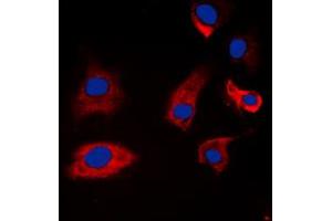 Immunofluorescent analysis of Synapsin 1 (pS9) staining in A549 cells. (SYN1 抗体  (N-Term, pSer9))