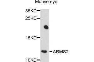 Western blot analysis of extracts of mouse eye cells, using ARMS2 antibody. (ARMS2 抗体)