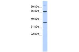 Image no. 1 for anti-Epsin 2 (EPN2) (AA 180-229) antibody (ABIN6743838) (Epsin 2 抗体  (AA 180-229))