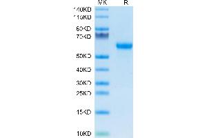 Mouse Factor H/CFH on Tris-Bis PAGE under reduced condition. (Complement Factor H Protein (CFH) (AA 875-1252) (His tag))