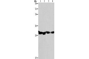 Western Blotting (WB) image for anti-2,4-Dienoyl CoA Reductase 1, Mitochondrial (DECR1) antibody (ABIN2432931) (DECR1 抗体)