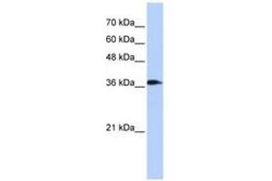 Image no. 1 for anti-ATPase, H+ Transporting, Lysosomal 38kDa, V0 Subunit D2 (ATP6V0D2) (C-Term) antibody (ABIN6741341) (ATP6V0D2 抗体  (C-Term))