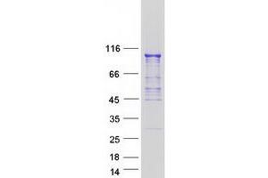Western Blotting (WB) image for Osteosarcoma Amplified 9, Endoplasmic Reticulum Lectin (OS9) (Transcript Variant 4) protein (Myc-DYKDDDDK Tag) (ABIN2727969)