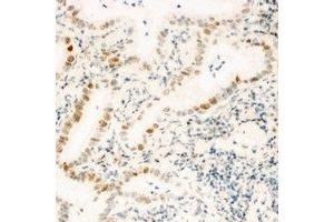 Immunohistochemical analysis of ZNF596 staining in human kidney formalin fixed paraffin embedded tissue section. (ZNF596 抗体)