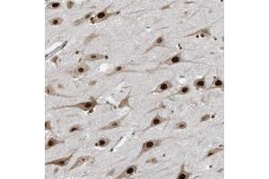 Immunohistochemical staining of human hippocampus with LBH polyclonal antibody  shows strong nuclear positivity in neuronal cells.
