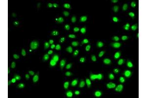 Immunofluorescence analysis of HeLa cells using TP53 antibody (ABIN5999084). (p53 抗体)