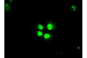 Anti-SATB1 mouse monoclonal antibody (ABIN2452628) immunofluorescent staining of COS7 cells transiently transfected by pCMV6-ENTRY SATB1 (RC200421). (SATB1 抗体)