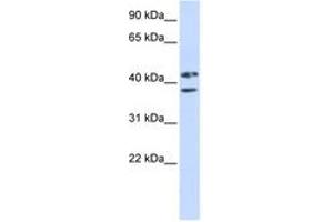Image no. 1 for anti-Zinc Finger Protein 265 (Zranb2) (AA 144-193) antibody (ABIN6743051) (ZNF265 抗体  (AA 144-193))