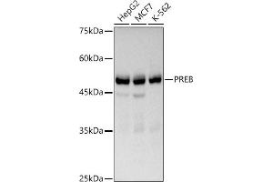 Western blot analysis of extracts of various cell lines, using PREB antibody (ABIN7269547) at 1:1000 dilution. (PREB 抗体)