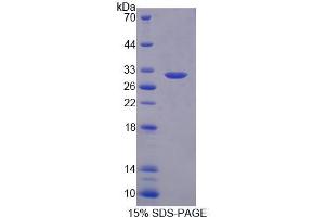 SDS-PAGE analysis of Human PLA2G3 Protein. (PLA2G3 蛋白)