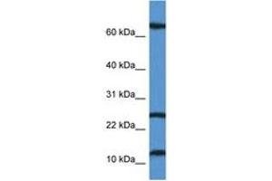 Image no. 1 for anti-TCR gamma Alternate Reading Frame Protein (TARP) (AA 7-56) antibody (ABIN6746905) (TARP 抗体  (AA 7-56))