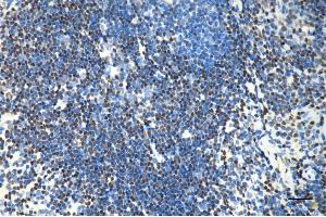 Immunohistochemistry was performed on paraffin-embedded mouse spleen using PARP antibody (ABIN7799867), 1:200).