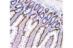 IHC analysis of HAUSP/USP7 using anti-HAUSP/USP7 antibody (ABIN6719603).