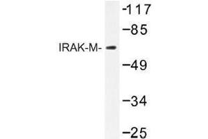 Image no. 1 for anti-Interleukin-1 Receptor-Associated Kinase 3 (IRAK3) antibody (ABIN317722) (IRAK3 抗体)