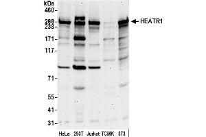 anti-HEAT Repeat Containing 1 (HEATR1) (AA 1200-1250) antibody