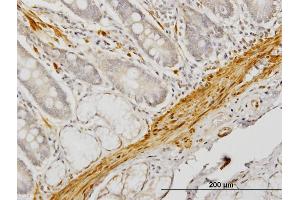 Immunoperoxidase of monoclonal antibody to CNN1 on formalin-fixed paraffin-embedded human small Intestine. (CNN1 抗体  (AA 1-297))