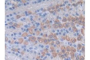 Detection of SDC1 in Rat Stomach Tissue using Polyclonal Antibody to Syndecan 1 (SDC1)