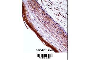 PGF Antibody immunohistochemistry analysis in formalin fixed and paraffin embedded human cervix tissue followed by peroxidase conjugation of the secondary antibody and DAB staining. (PLGF 抗体  (AA 120-148))