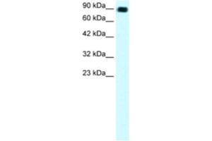 Western Blotting (WB) image for anti-Zinc Finger Protein 828 (ZNF828) antibody (ABIN2460309) (ZNF828 抗体)