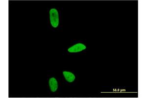 Immunofluorescence of monoclonal antibody to CD3EAP on HeLa cell. (CD3EAP 抗体  (AA 2-110))