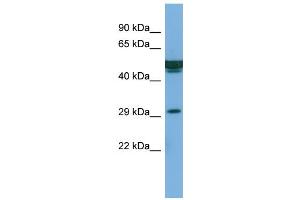 Host:  Rabbit  Target Name:  FAM3B  Sample Type:  PANC1 Whole cell lysates  Antibody Dilution:  1. (FAM3B 抗体  (Middle Region))