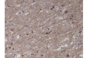 DAB staining on IHC-P; Samples: Human Cerebrum Tissue (CKM 抗体)