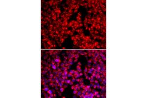 Immunofluorescence analysis of U2OS cells using MTTP antibody. (MTTP 抗体)