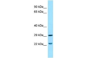 WB Suggested Anti-SLC25A10 Antibody Titration: 1. (SLC25A10 抗体  (Middle Region))