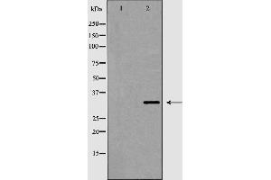 Western blot analysis of VDAC2 expression in HeLa. (VDAC2 抗体)
